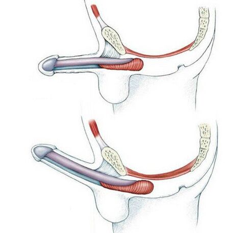 Pubococcygeus kasını çalıştırmadan ve sonra penis